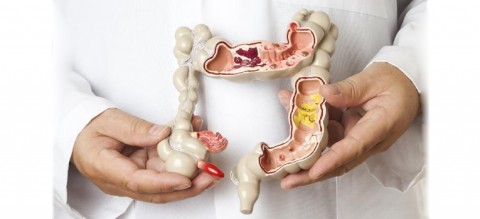 Diet-and-Colorectal-Cancer