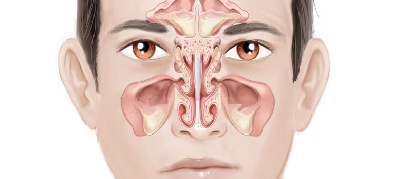 5-Quick-steps-to-handle-a-sudden-sinus-pain