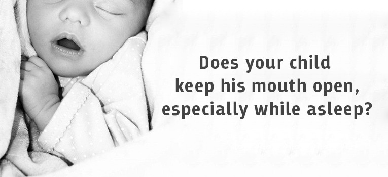 Does-your-child-keep-his-mouth-open-especially-while-asleep