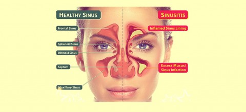 5-Symptoms-of-a-Sinus-Infection-and-When-to-Visit-the-Doctor
