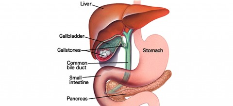How-Obesity-as-well-as-Weight-Reduction-is-Risk-to-Developing-Gallbladder-Stone
