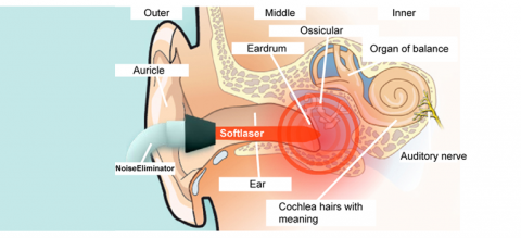 Can-Hearing-Aids-Help-Patient-with-Tinnitus