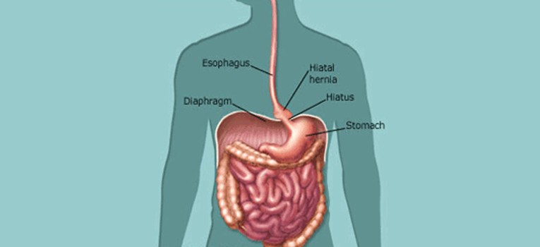 What-to-Expect-Before-and-After-Hernia-Surgery