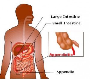 Appendix