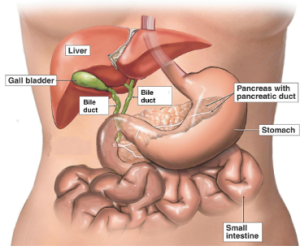 Cholecystitis