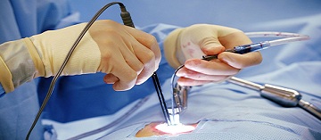 Minimal Invasive Surgery